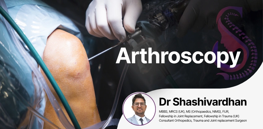 Arthroscopy in Hyderabad - S&S Clinics