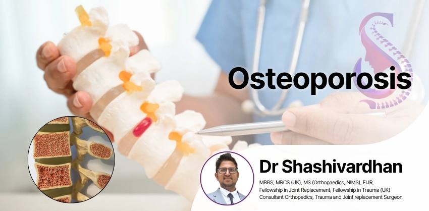 Osteoporosis Treatment in Hyderabad - S&S Clinics