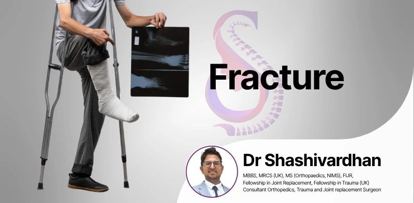 Fracture Treatment at S&S Clinics, Manikonda, Hyderabad