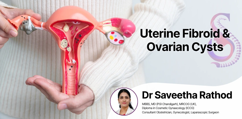 Fibroid & Cyst at S&S Clinics, Manikonda, Hyderabad